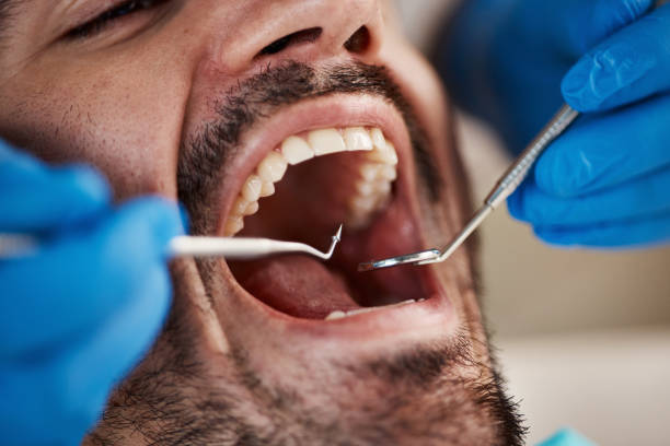 Best Emergency Treatment for Dental Infections or Abscesses in Woodburn, VA
