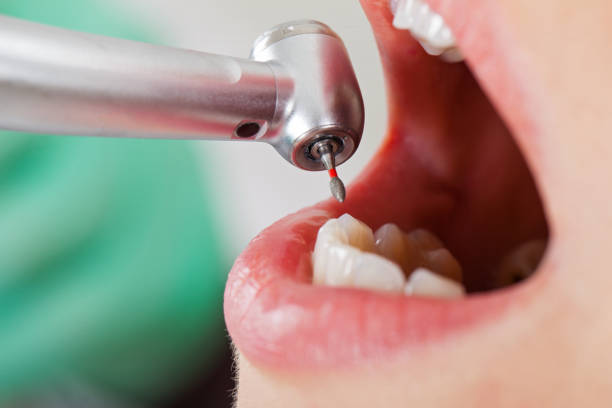 Best Cosmetic Emergency Dentistry in Woodburn, VA